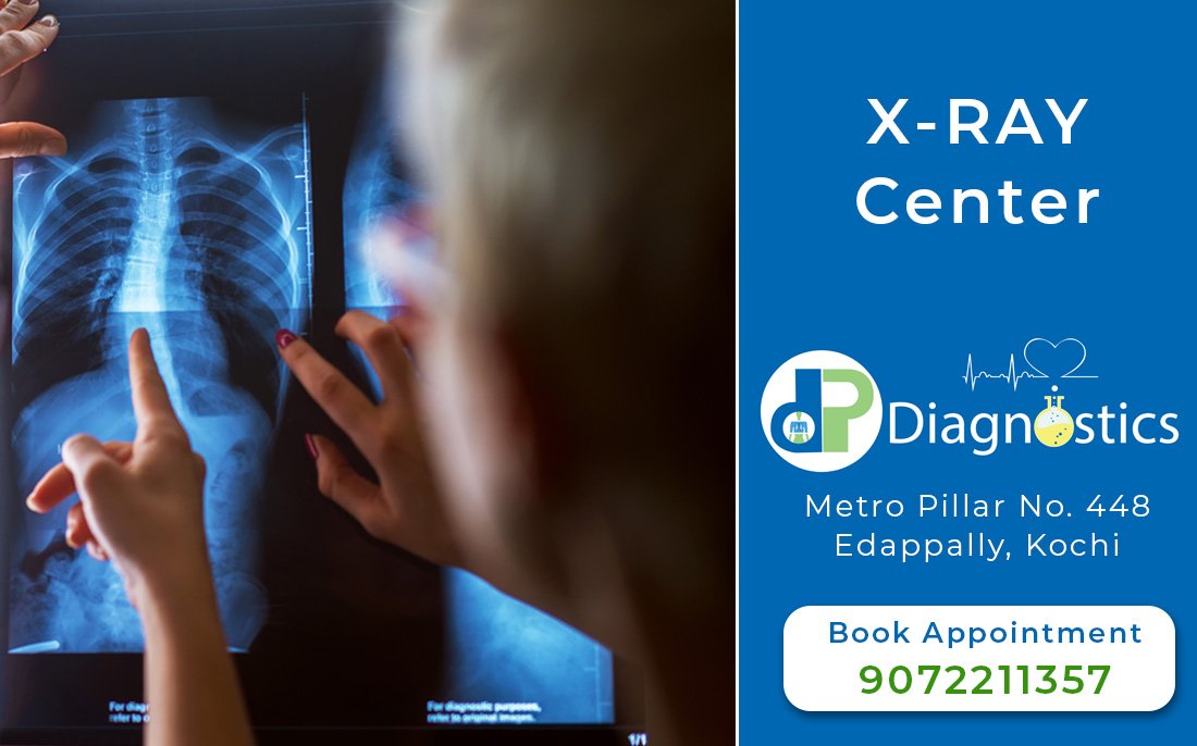 X-ray Center at Edappally. Digital x-ray, Chest x-ray, KUB X-ray (Kidney, Ureter, Bladder), Knee and Shoulder x-ray,