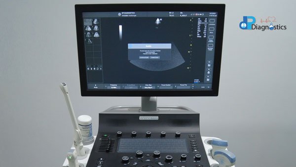 DP Diagnostics - Ultrasound Scanning machine - Scanning Center at Edappally